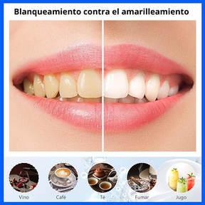 COMBO 2X1 Láminas Blanqueadoras de Dientes 3D White
